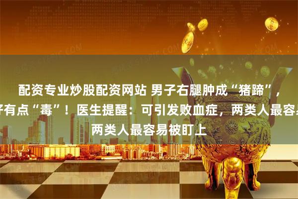 配资专业炒股配资网站 男子右腿肿成“猪蹄”，这个癖好有点“毒”！医生提醒：可引发败血症，两类人最容易被盯上